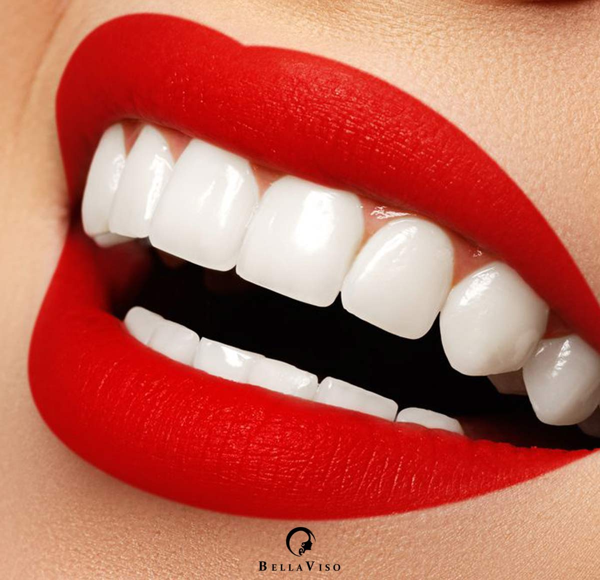 Smile Perfection: Discovering the Best Medical Center for Dental Veneers in Dubai