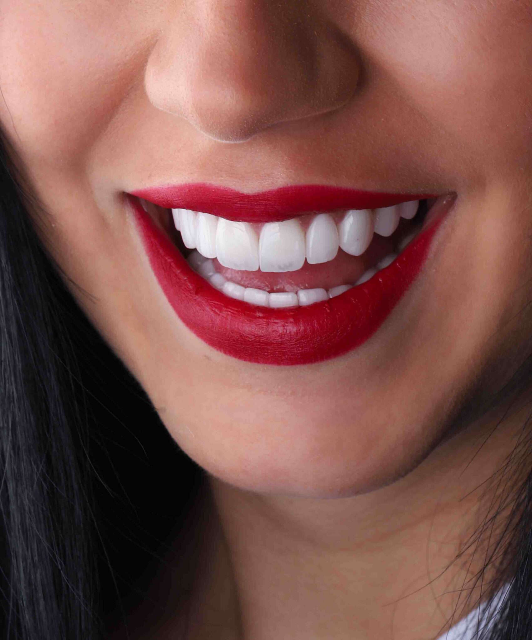 Enhance Your Smile: Exploring the Best Lip Filler Treatment in Dubai