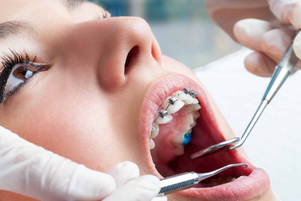 Best Orthodontics Clinic & Dentist in Dubai